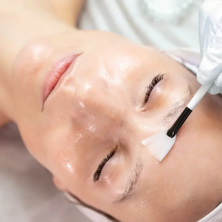 https://example.com/image-of-expert-tips-for-microneedling.jpg